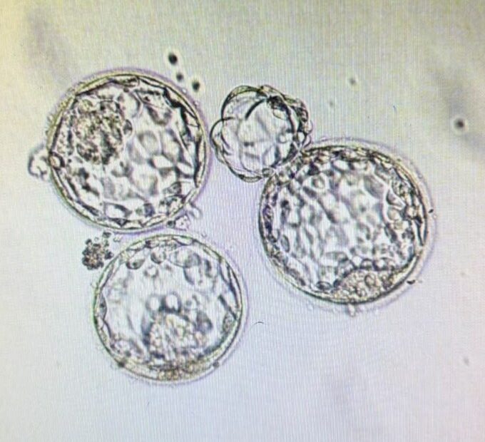 cuidados após transferência de embriões: Blastocistos transferidos: embriões no 5º dia de desenvolvimento vistos ao microscópio no laboratório da Fértil Reprodução Humana