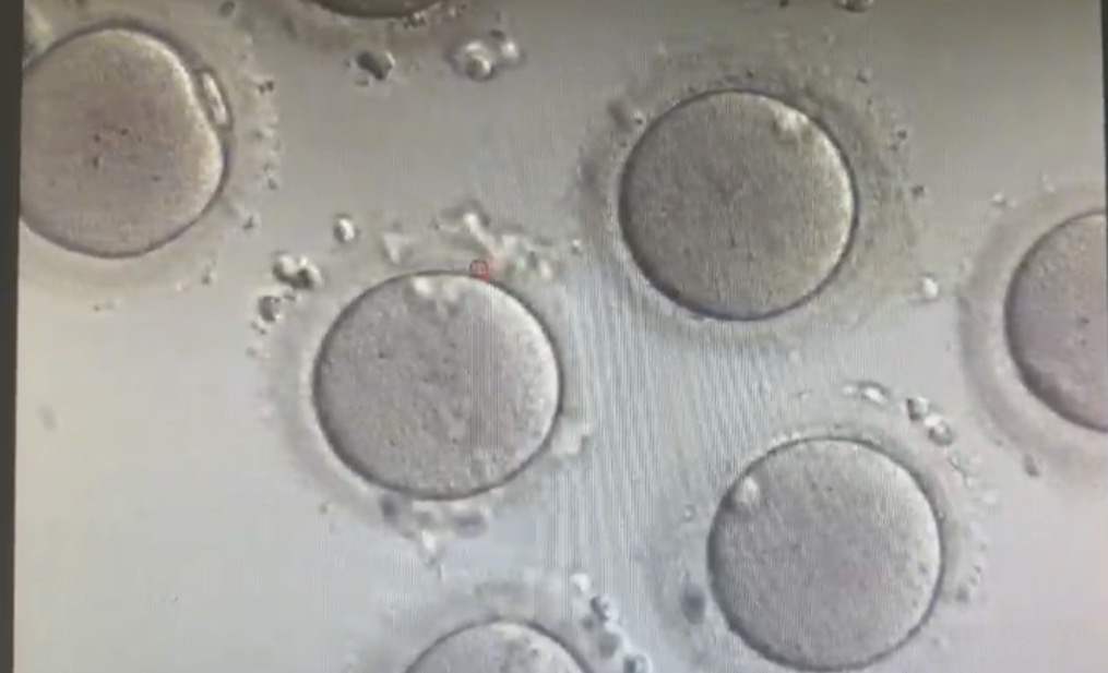 Óvulos coletados observados ao microscópio em laboratório de reprodução assistida.