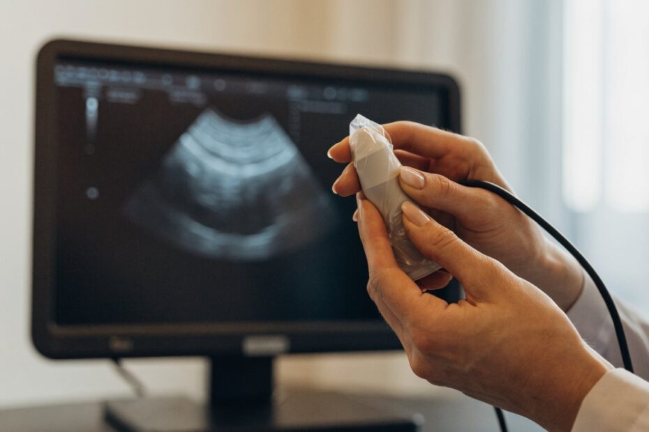 funciona a inseminação artificial: Médica prepara transdutor de ultrassom transvaginal diante do monitor com imagem do exame